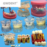 Różne modele zębów dentystycznych są używane do nauczania i materiału dentystycznego szpitala 1